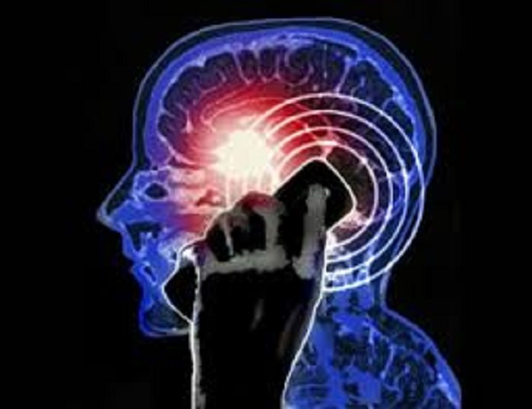 head x-ray using mobile phone